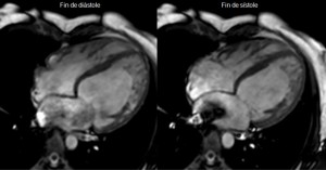 img-art-resonancia-01