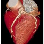 RM Cardiovascular