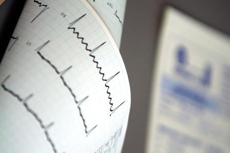 Electrocardiograma