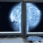 Radiología e imagen Guadalajara Jalisco diagnostico especializado por imagen mexica