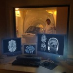 Resonancia magnética con anestesia