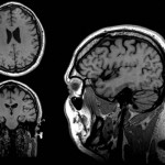 resonancia magnetica cerebro dei