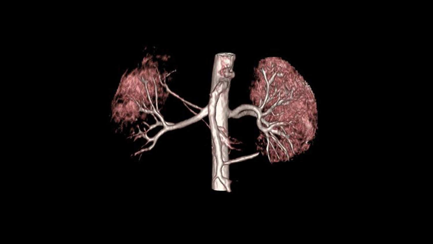 Inhance_clinical_2