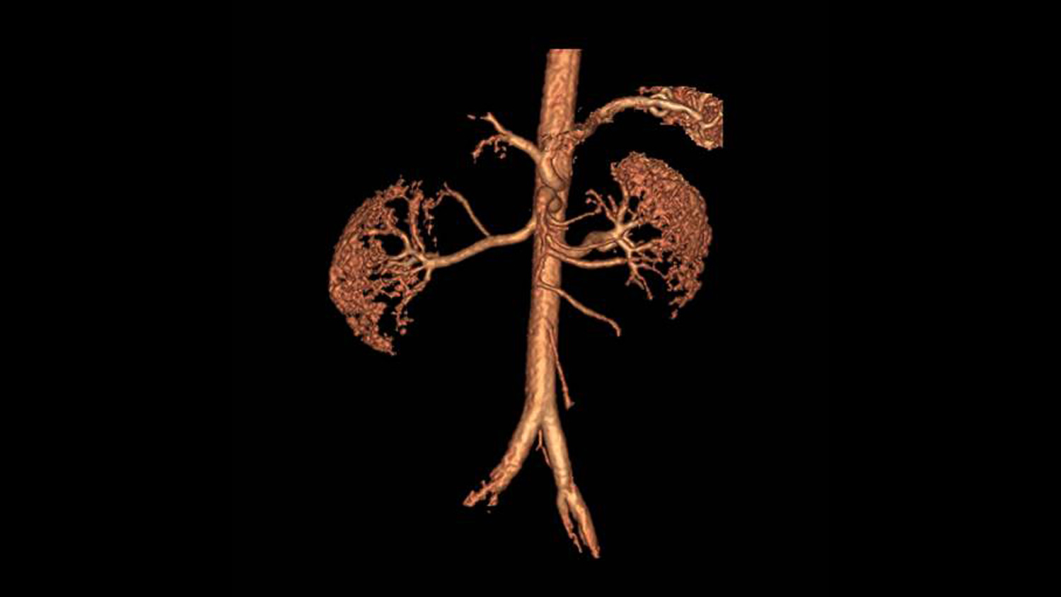 Inhance_clinical_3