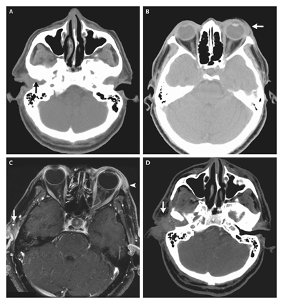 FIG2