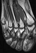 getThumb