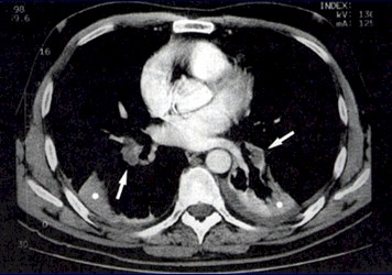 Cáncer de próstata, diagnóstico