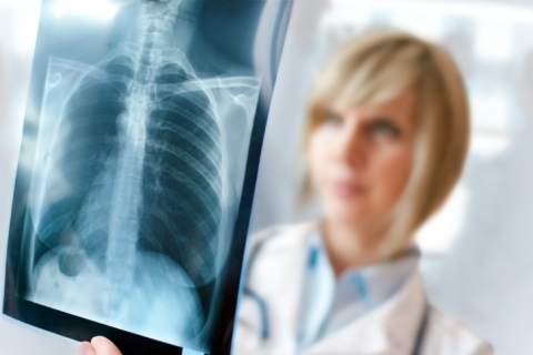 Importancia de la radiografía de Torax