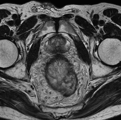 estudios-resonancia-pelvis