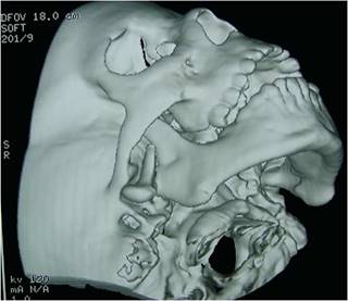 Tomografía Axial en niños